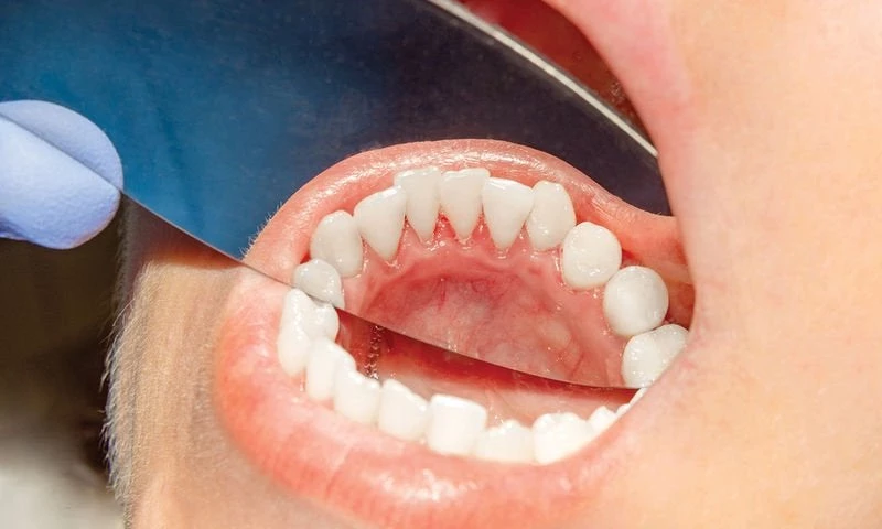 Τα συμπτώματα του στόματος που δεν πρέπει να αγνοήσετε